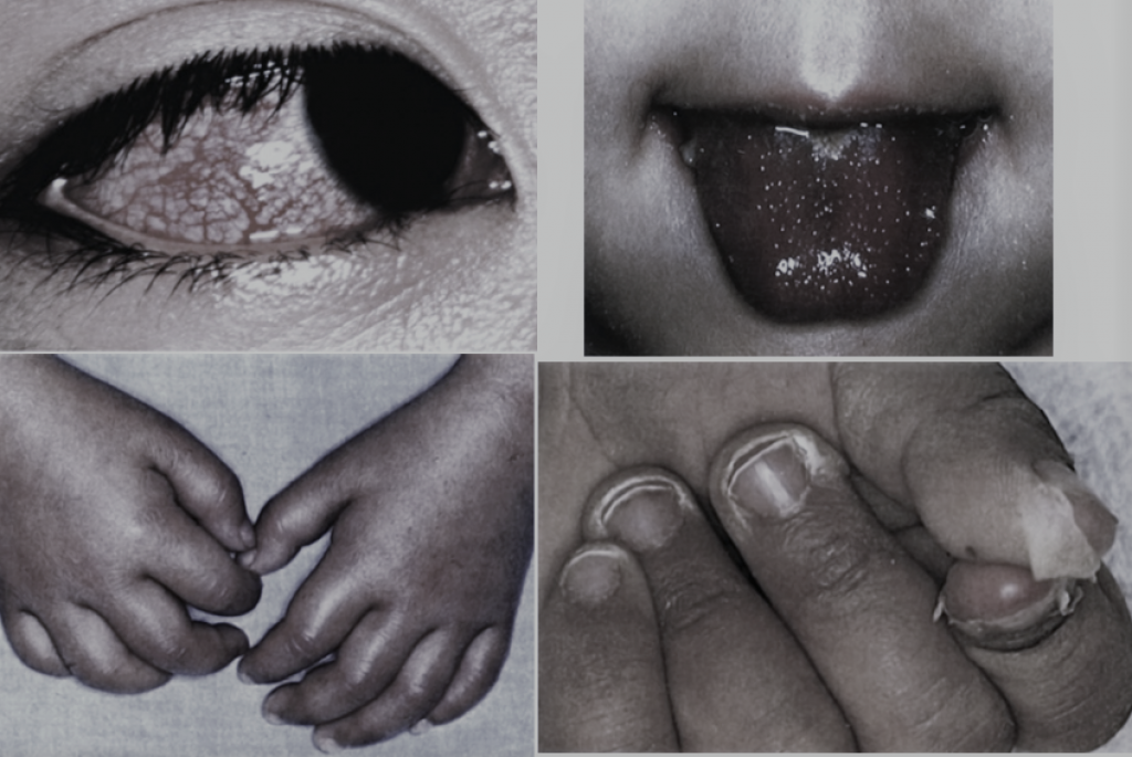 One Photos - GBWUl3aGLV1MVG37tlzyKr3bn.png